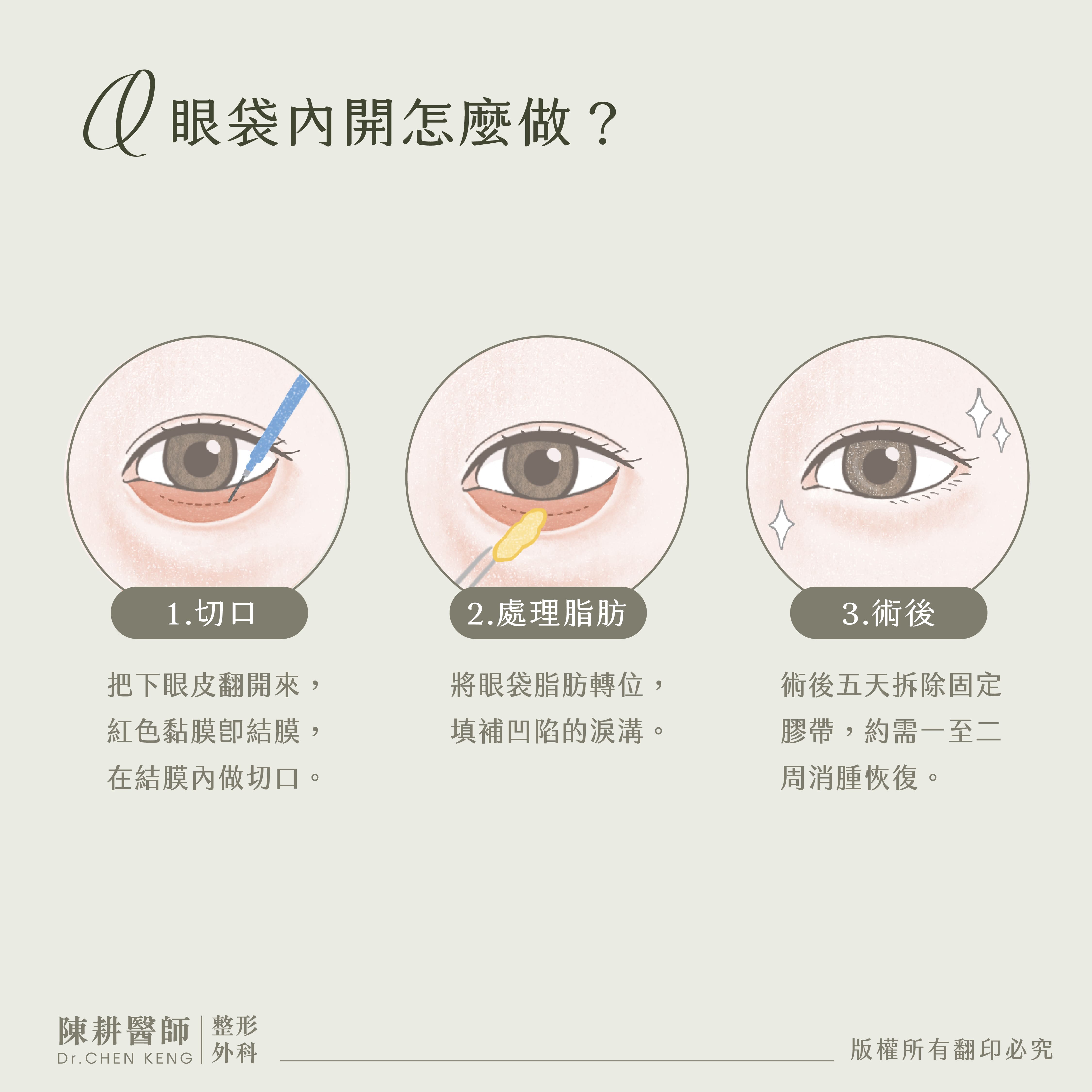 什麼是眼袋內開?