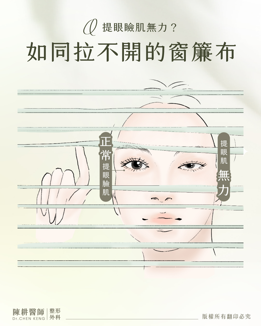 提眼瞼肌手術