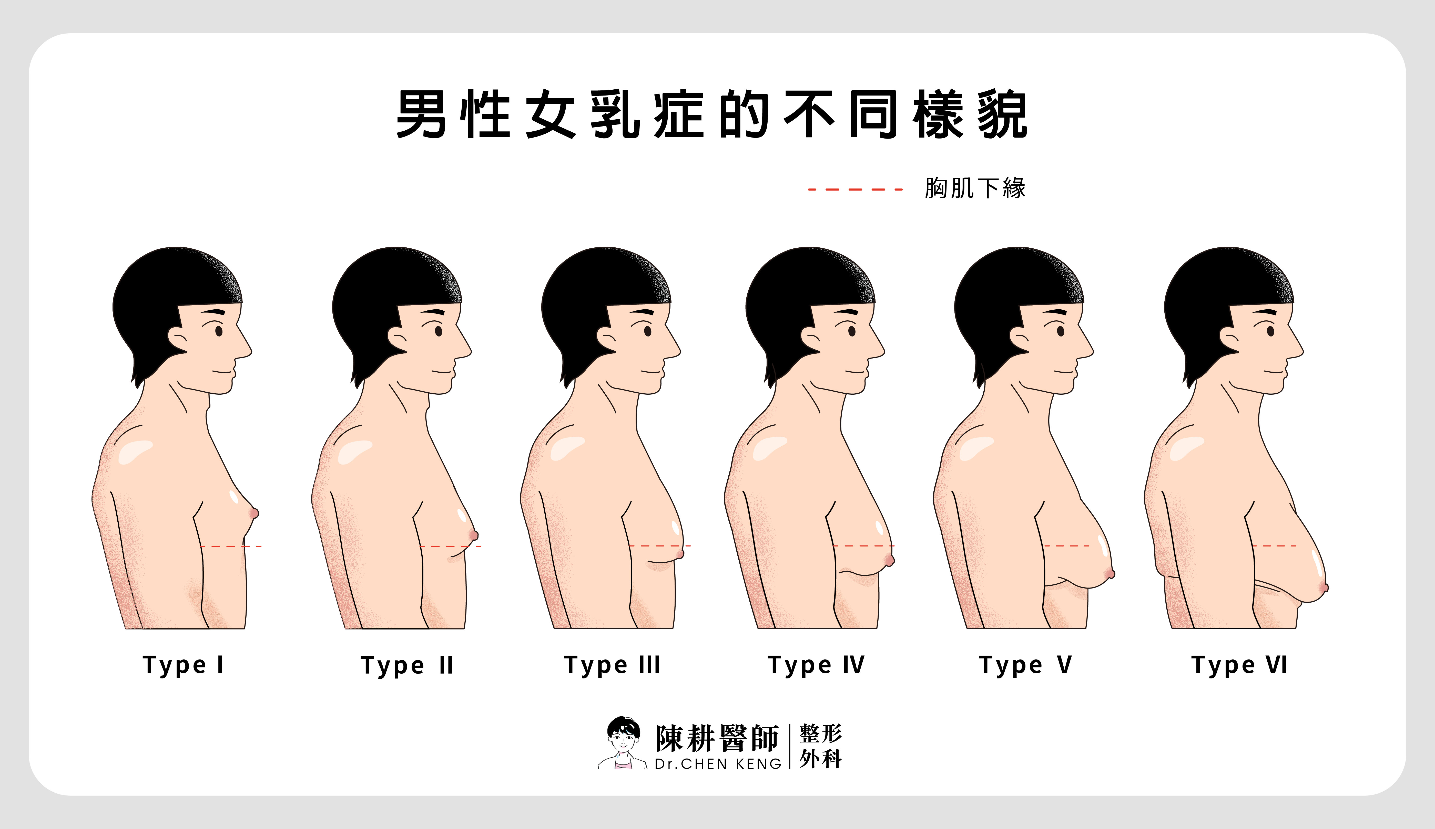 眼周年輕化手術