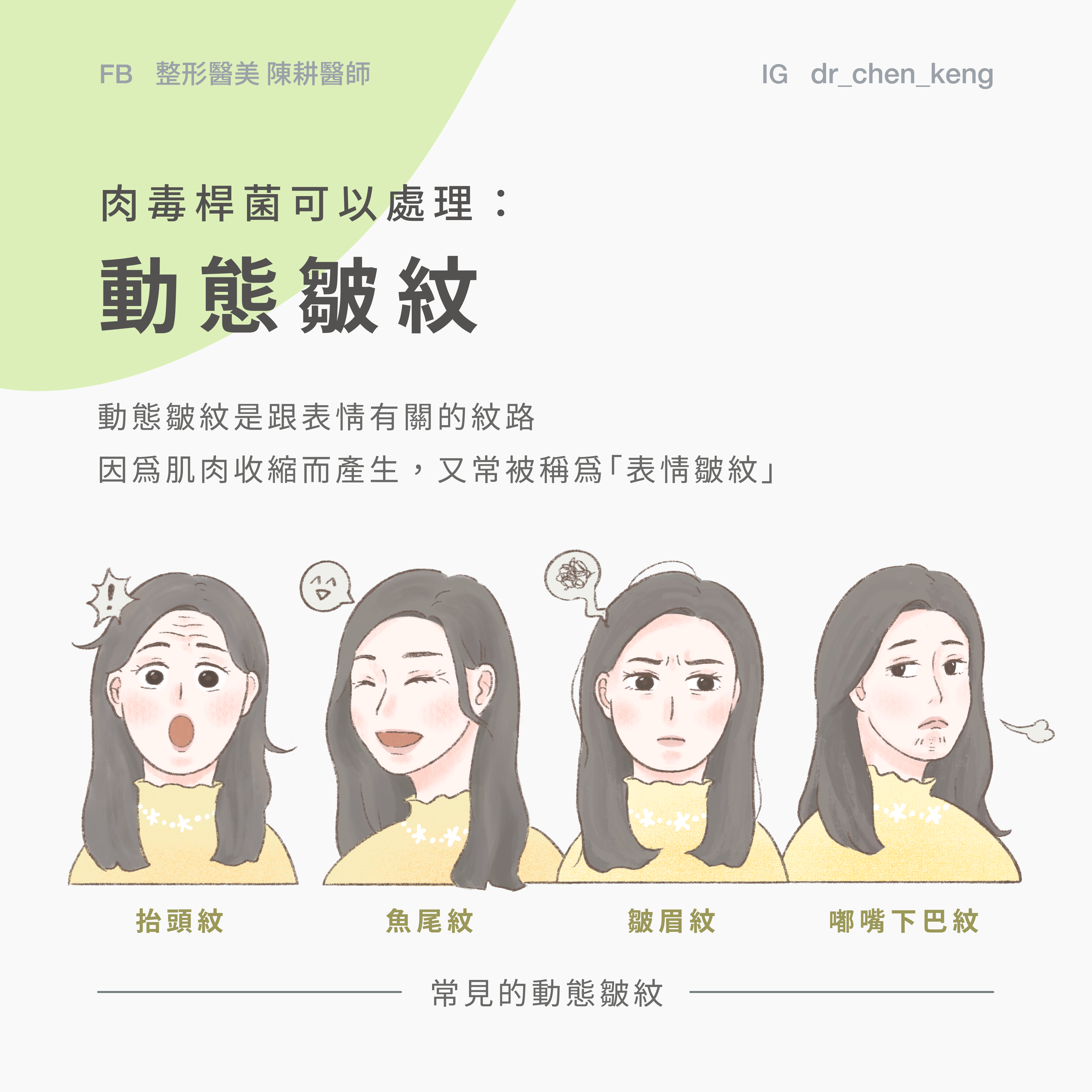 肉毒桿菌處理動態紋路