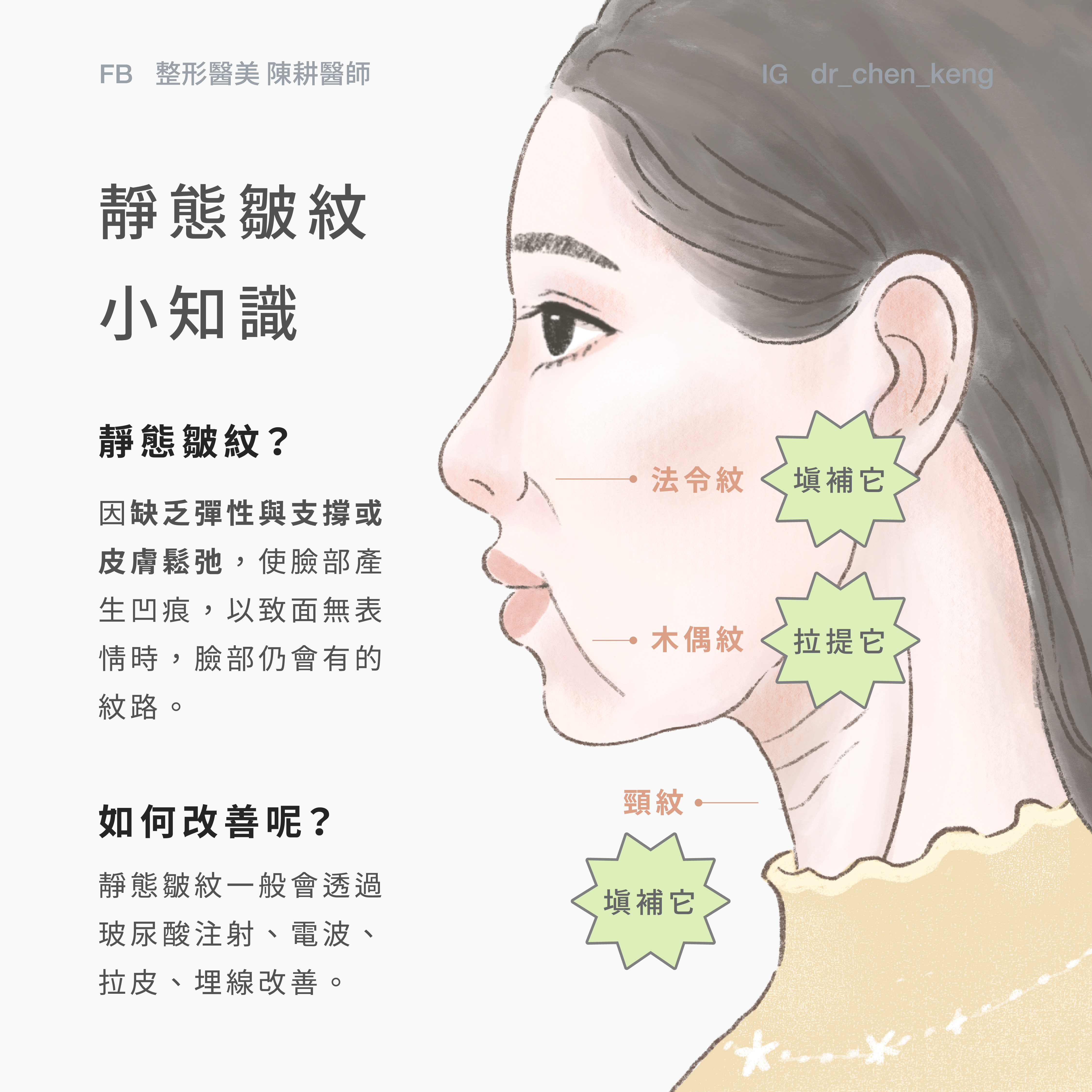 如何改善靜態皺紋? 玻尿酸、埋線拉提、電波、音波